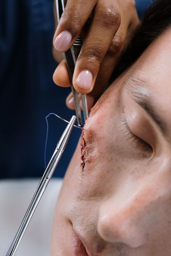 When Should You See a Doctor for a Cut?