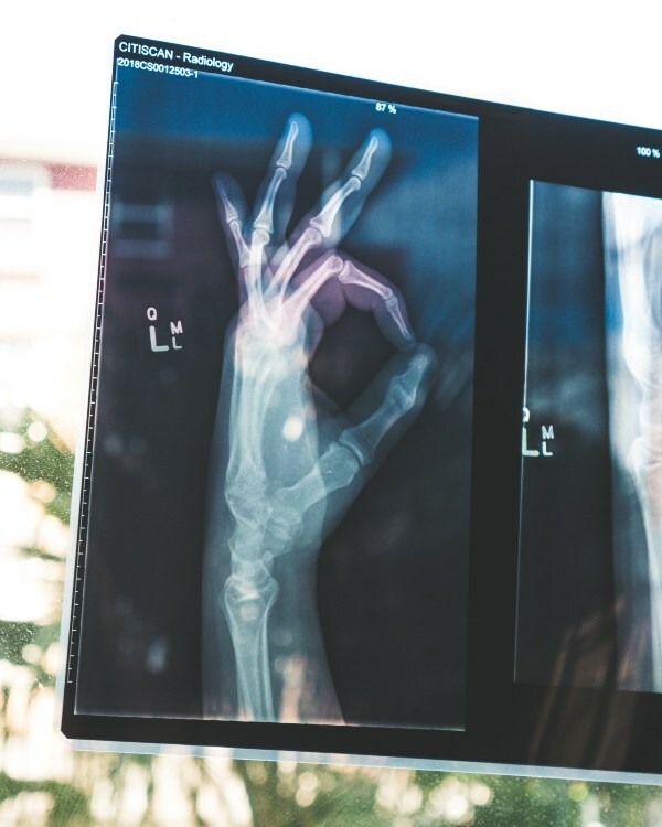 How to Set a Broken Bone or Treat a Dislocated Joint