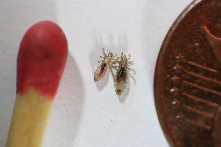 Heads Up: Look Out for Lice Seeking a Blood Meal in Scalp
